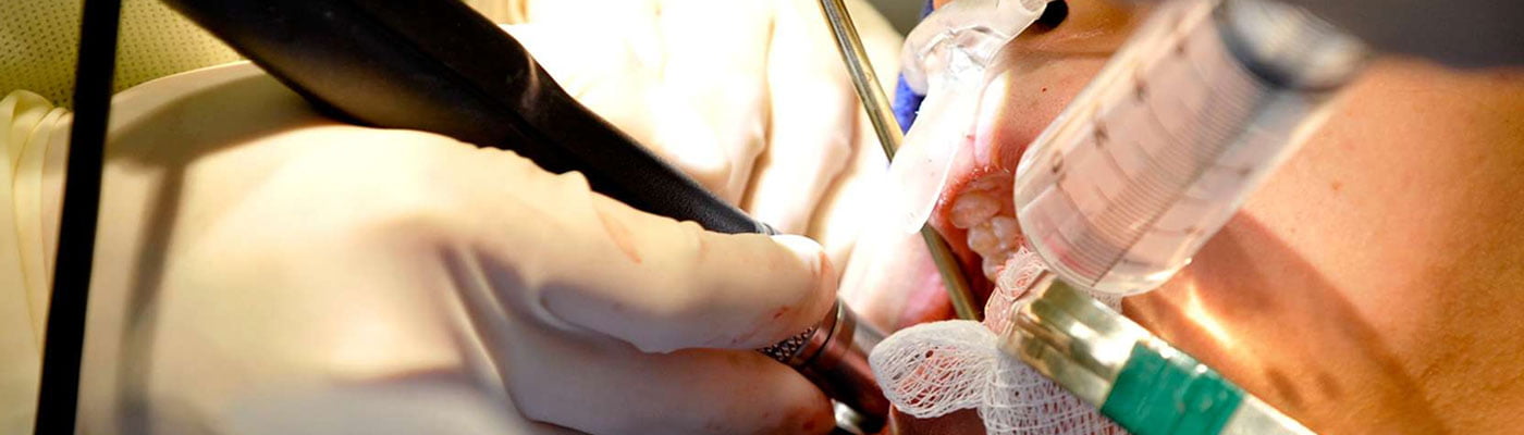 Oral & Maxillofacial Surgery